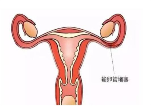 宝宝为什么总是黄昏闹,如何安抚在黄昏哭闹的宝宝