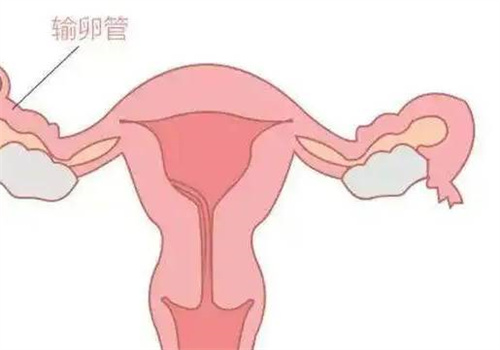 人工授精只是一项小手术，并不会让女性觉得痛